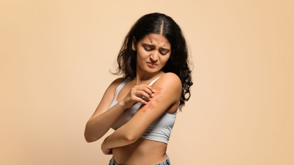 Get Psoriasis Treatment Online